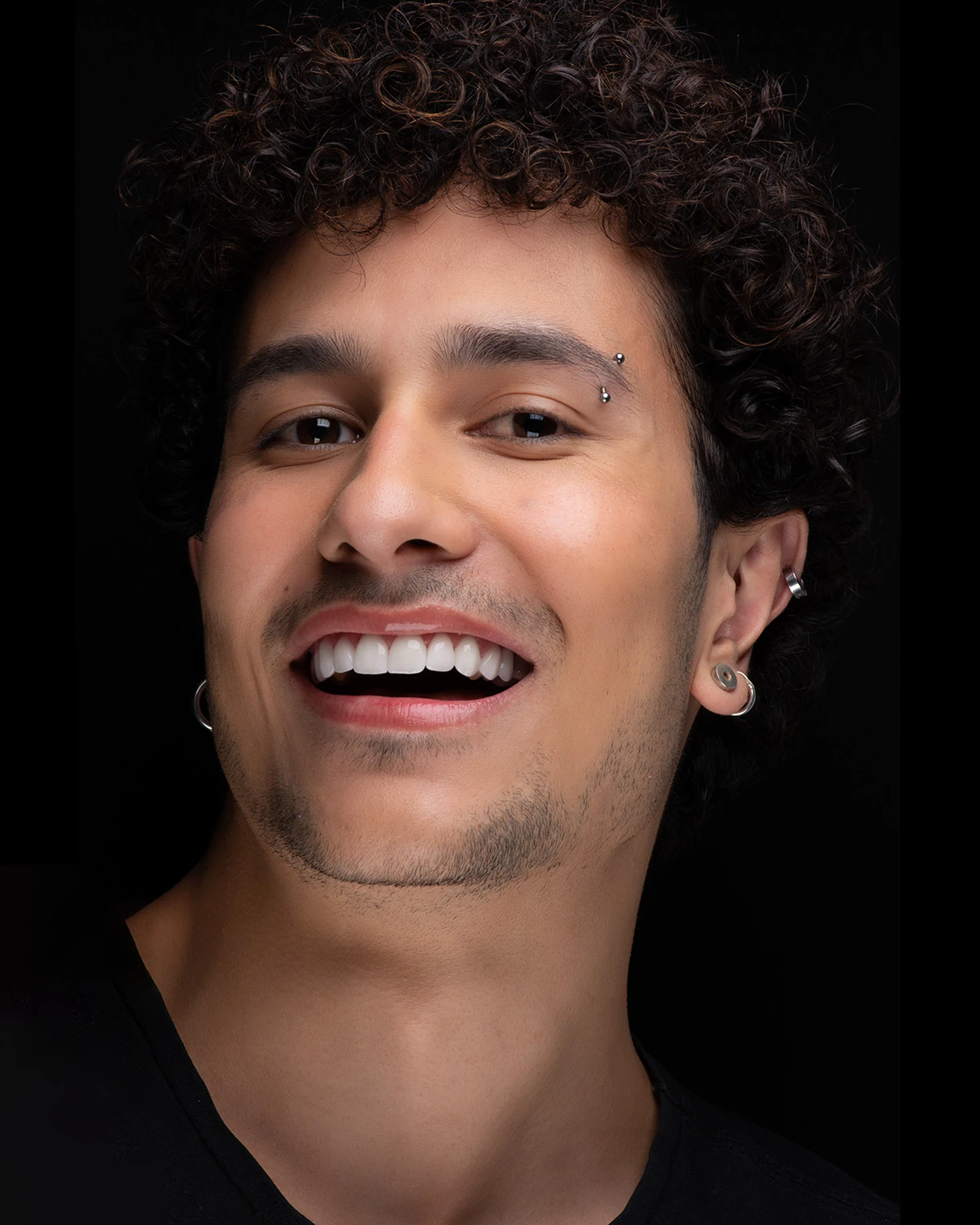 Close de um sorriso com dentes claros, alinhados e de proporção uniforme.